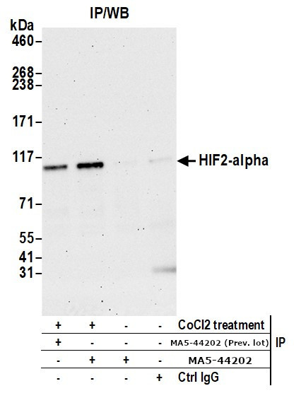 HIF-2 alpha Antibody in Immunoprecipitation (IP)