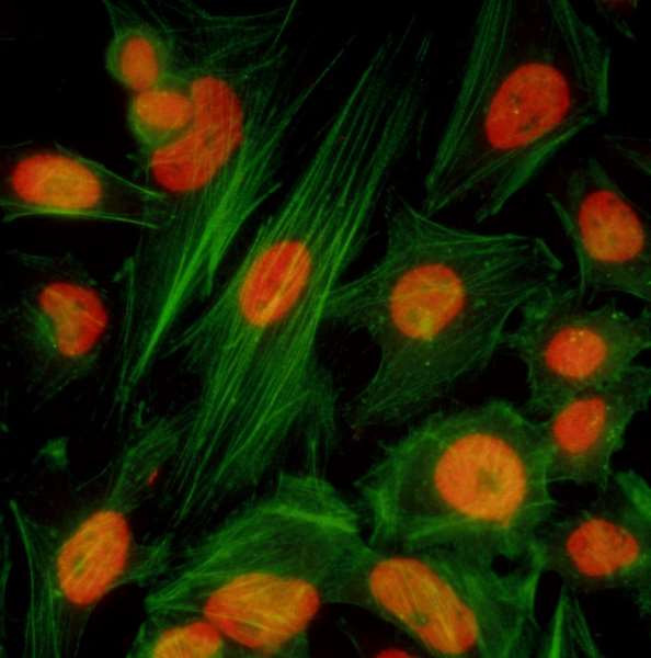 BRD4 Antibody in Immunocytochemistry (ICC/IF)