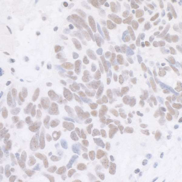 CDK7 Antibody in Immunohistochemistry (Paraffin) (IHC (P))