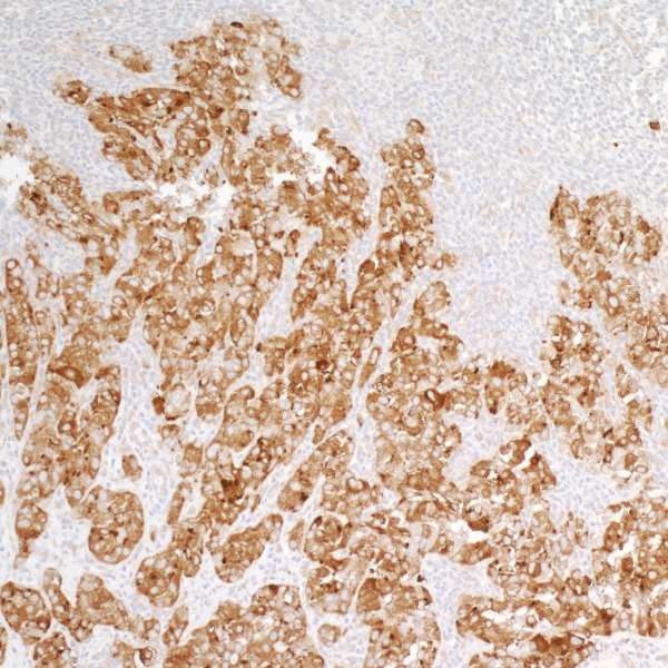 PTPN12 Antibody in Immunohistochemistry (Paraffin) (IHC (P))