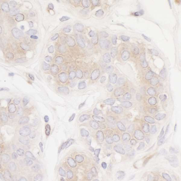 PTPN12 Antibody in Immunohistochemistry (Paraffin) (IHC (P))