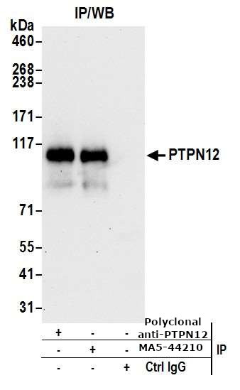 PTPN12 Antibody in Immunoprecipitation (IP)