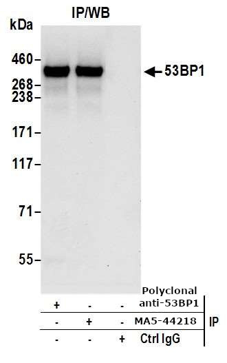 53BP1 Antibody in Immunoprecipitation (IP)