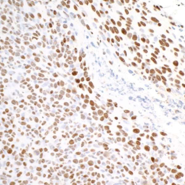 TRIM28 Antibody in Immunohistochemistry (Paraffin) (IHC (P))