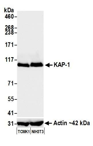 TRIM28 Antibody in Western Blot (WB)