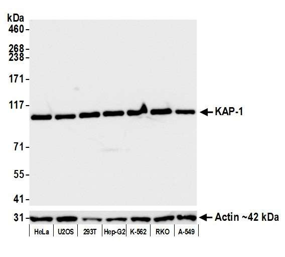 TRIM28 Antibody in Western Blot (WB)