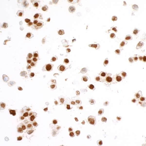 FUS Antibody in Immunocytochemistry (ICC/IF)