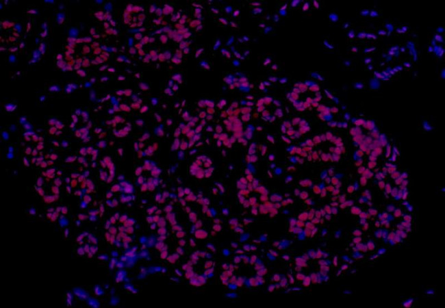 FUS Antibody in Immunohistochemistry (Paraffin) (IHC (P))