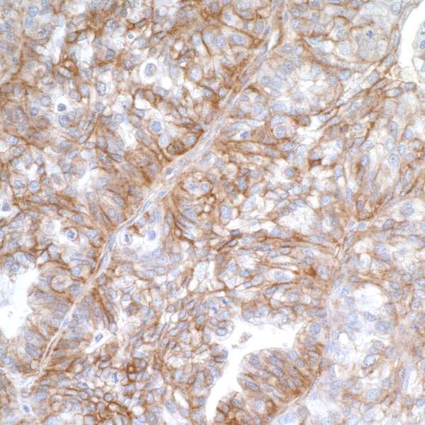 B7-H3 (CD276) Antibody in Immunohistochemistry (Paraffin) (IHC (P))