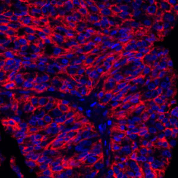 B7-H3 (CD276) Antibody in Immunohistochemistry (Paraffin) (IHC (P))