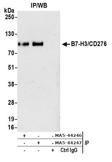 B7-H3 (CD276) Antibody in Immunoprecipitation (IP)