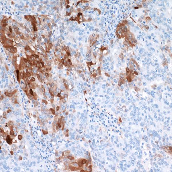 IDO1 Antibody in Immunohistochemistry (Paraffin) (IHC (P))