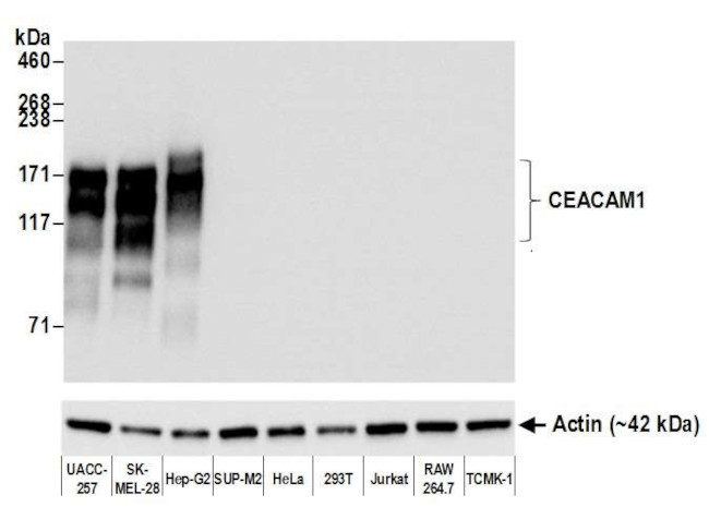 CEACAM1/CEACAM5 Antibody in Western Blot (WB)