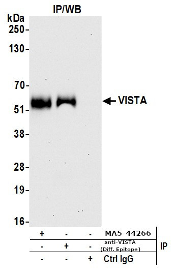 VISTA Antibody in Immunoprecipitation (IP)