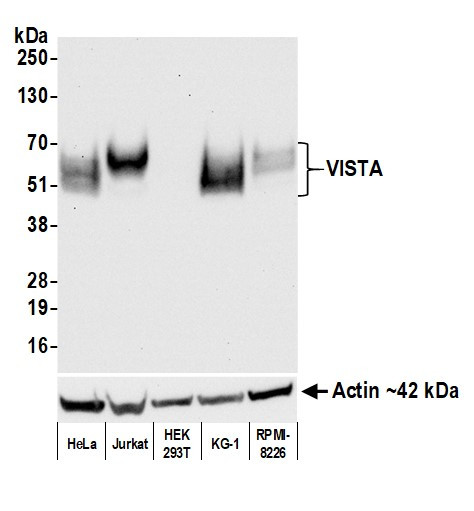 VISTA Antibody in Western Blot (WB)