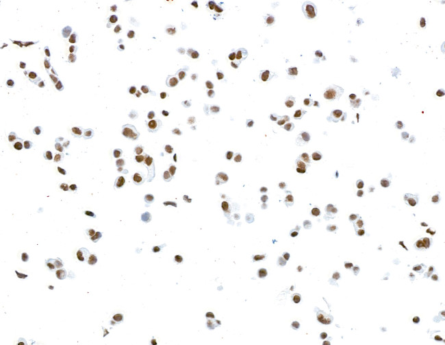 CTCF Antibody in Immunocytochemistry (ICC/IF)