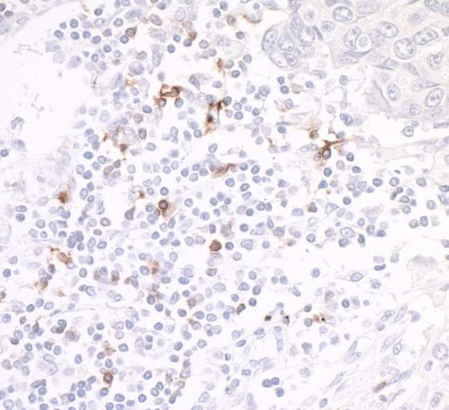OX40 (CD134) Antibody in Immunohistochemistry (Paraffin) (IHC (P))