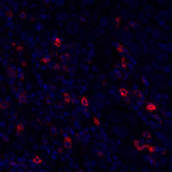 OX40 (CD134) Antibody in Immunohistochemistry (Paraffin) (IHC (P))