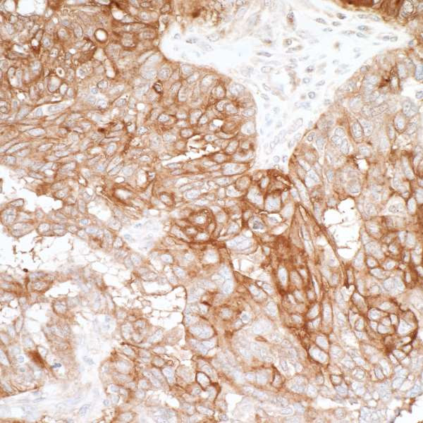 B7-H4 Antibody in Immunohistochemistry (Paraffin) (IHC (P))