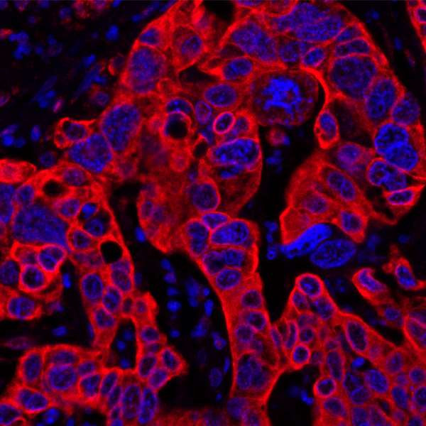 B7-H4 Antibody in Immunohistochemistry (Paraffin) (IHC (P))