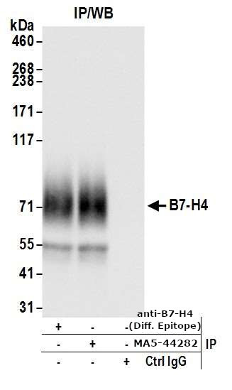 B7-H4 Antibody in Immunoprecipitation (IP)