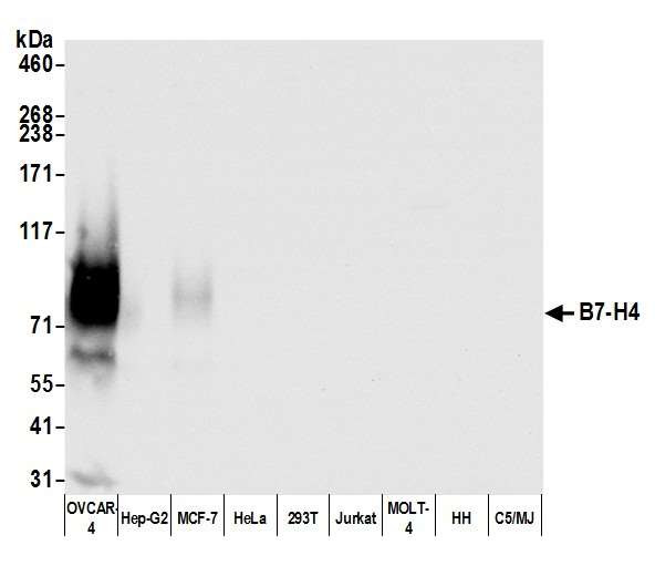 B7-H4 Antibody in Western Blot (WB)