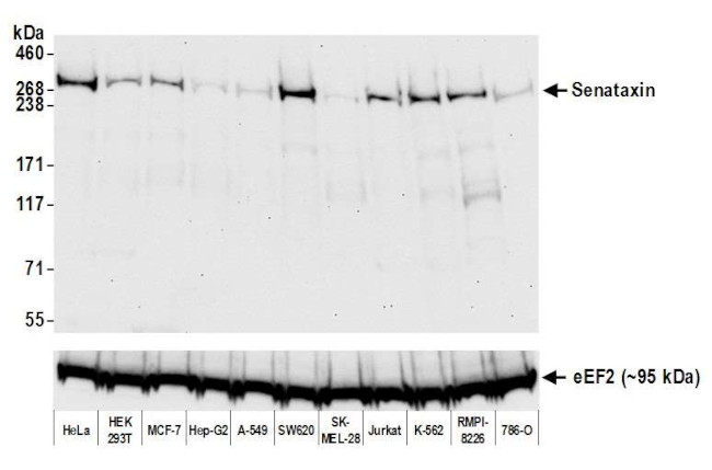 SETX Antibody in Western Blot (WB)