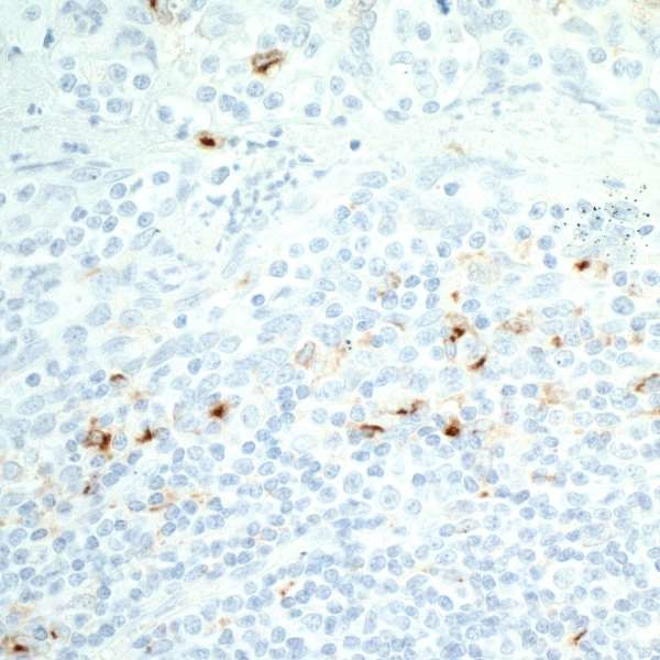 CD137 (4-1BB) Antibody in Immunohistochemistry (Paraffin) (IHC (P))