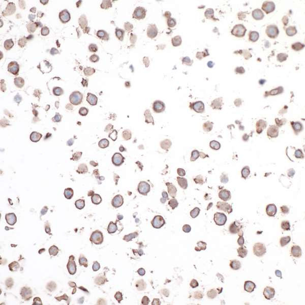 CD30 Antibody in Immunocytochemistry (ICC/IF)