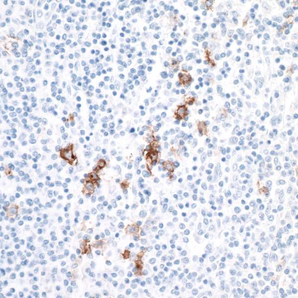 CD30 Antibody in Immunohistochemistry (Paraffin) (IHC (P))