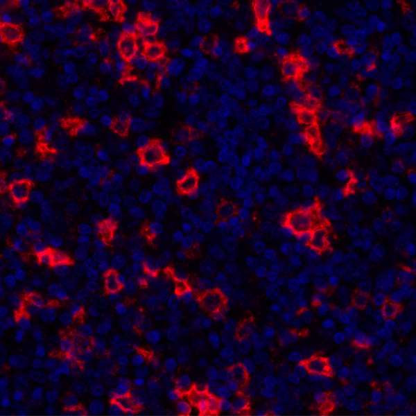 CD30 Antibody in Immunohistochemistry (Paraffin) (IHC (P))