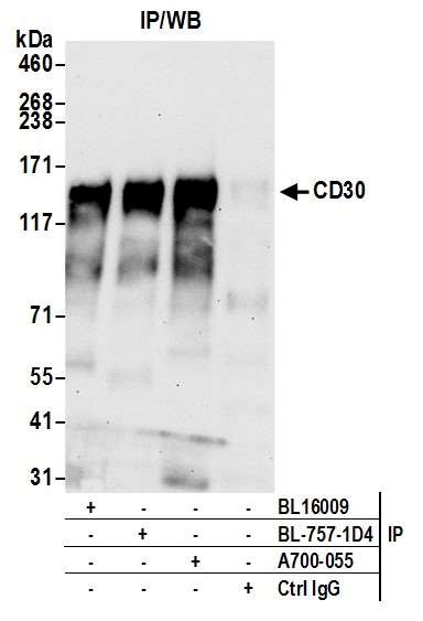 CD30 Antibody in Immunoprecipitation (IP)