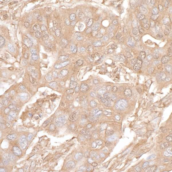 beta Actin Antibody in Immunohistochemistry (Paraffin) (IHC (P))