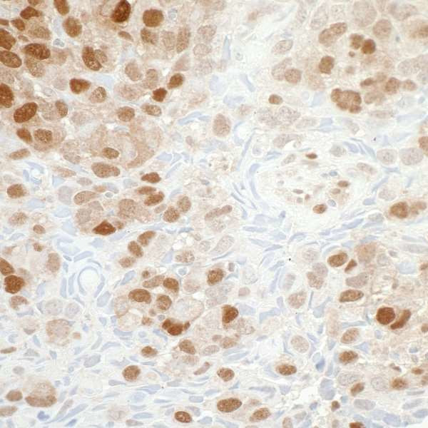 NAMPT Antibody in Immunohistochemistry (Paraffin) (IHC (P))