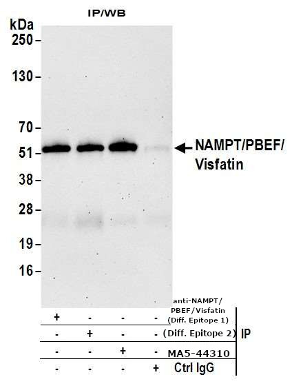 NAMPT Antibody in Immunoprecipitation (IP)