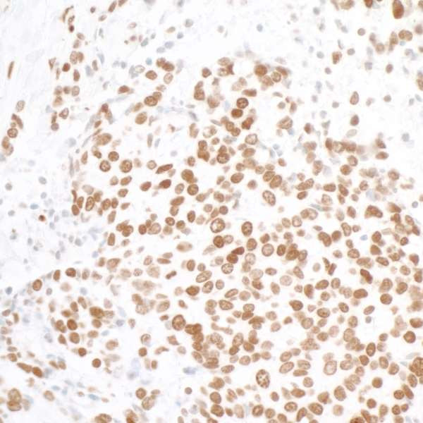 Histone H2A.X Antibody in Immunohistochemistry (Paraffin) (IHC (P))