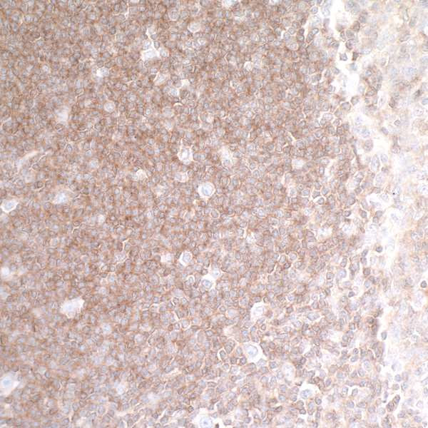 TNFRSF14 (HVEM) Antibody in Immunohistochemistry (Paraffin) (IHC (P))