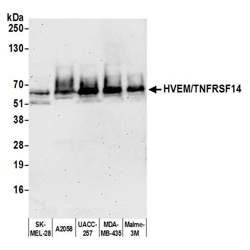 TNFRSF14 (HVEM) Antibody in Western Blot (WB)