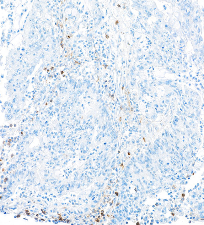 CD226 (DNAM-1) Antibody in Immunohistochemistry (Paraffin) (IHC (P))