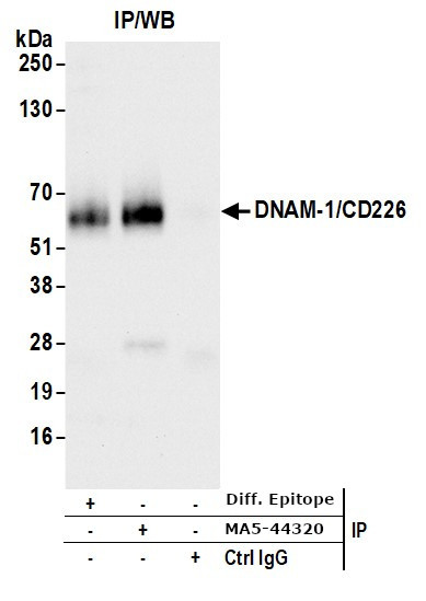 CD226 (DNAM-1) Antibody in Immunoprecipitation (IP)