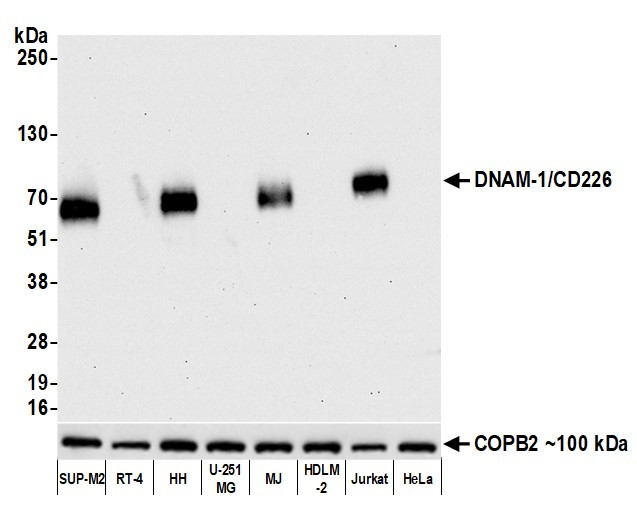 CD226 (DNAM-1) Antibody in Western Blot (WB)
