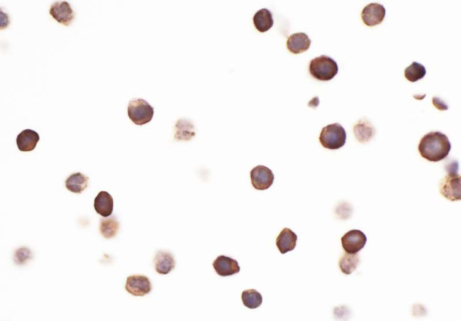 CD96 Antibody in Immunocytochemistry (ICC/IF)