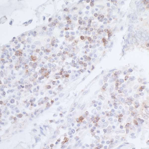 CD96 Antibody in Immunohistochemistry (Paraffin) (IHC (P))