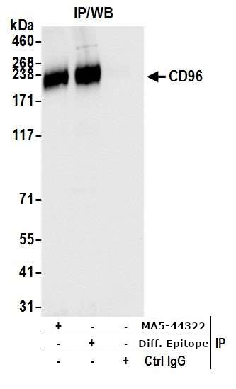 CD96 Antibody in Immunoprecipitation (IP)