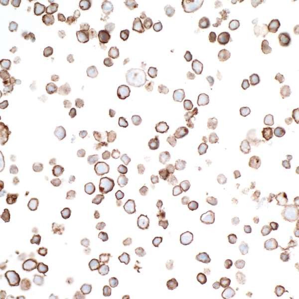 GITR (TNFRSF18) Antibody in Immunocytochemistry (ICC/IF)