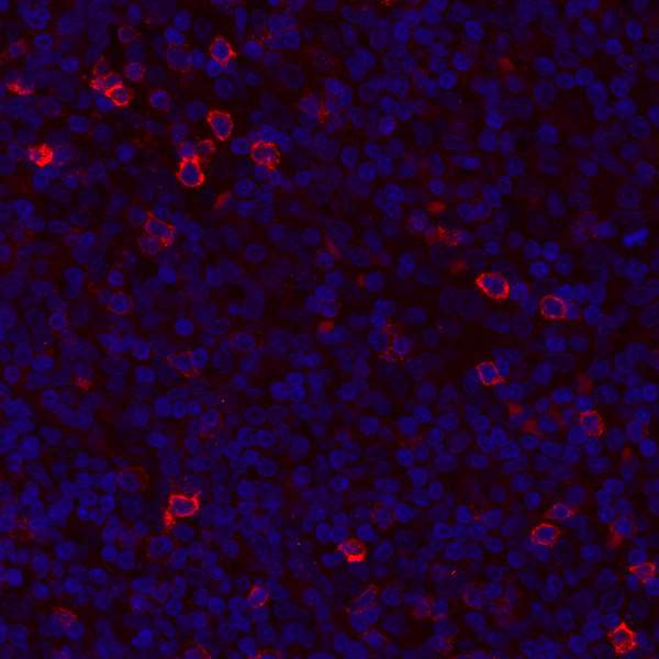 GITR (TNFRSF18) Antibody in Immunohistochemistry (Paraffin) (IHC (P))