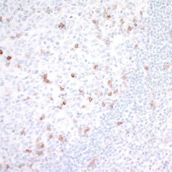 GITR (TNFRSF18) Antibody in Immunohistochemistry (Paraffin) (IHC (P))