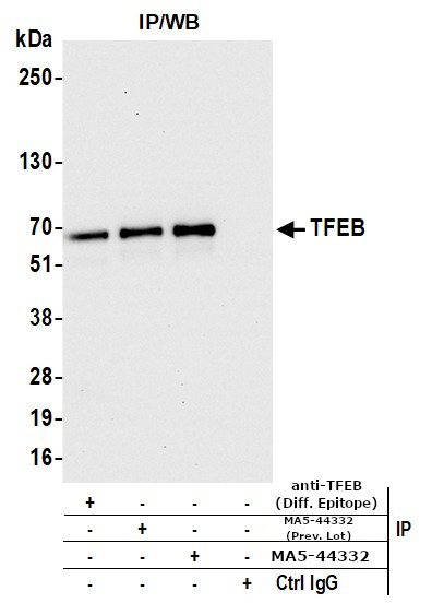 TFEB Antibody in Immunoprecipitation (IP)