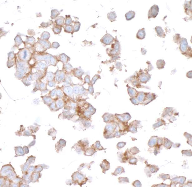 CD112 (Nectin-2) Antibody in Immunocytochemistry (ICC/IF)