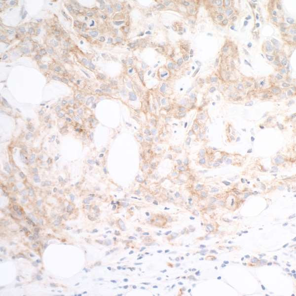 CD112 (Nectin-2) Antibody in Immunohistochemistry (Paraffin) (IHC (P))